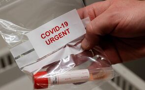 Portugal com mais 70 mortes e 4.097 casos de covid-19. Doentes recuperados com menor subida num mês